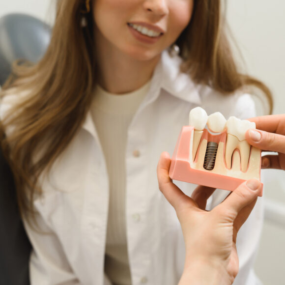 The Power of Dental Implants