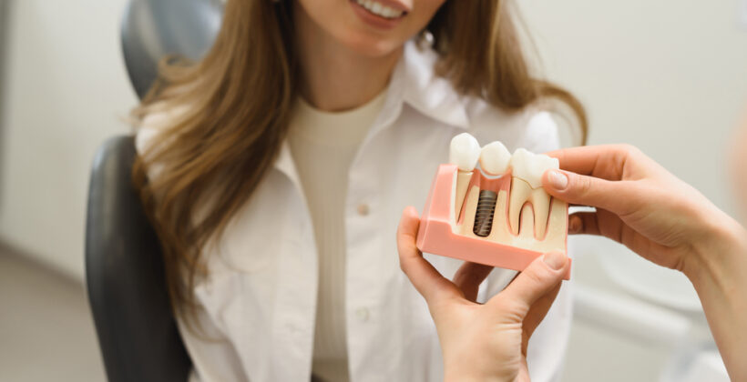 The Power of Dental Implants